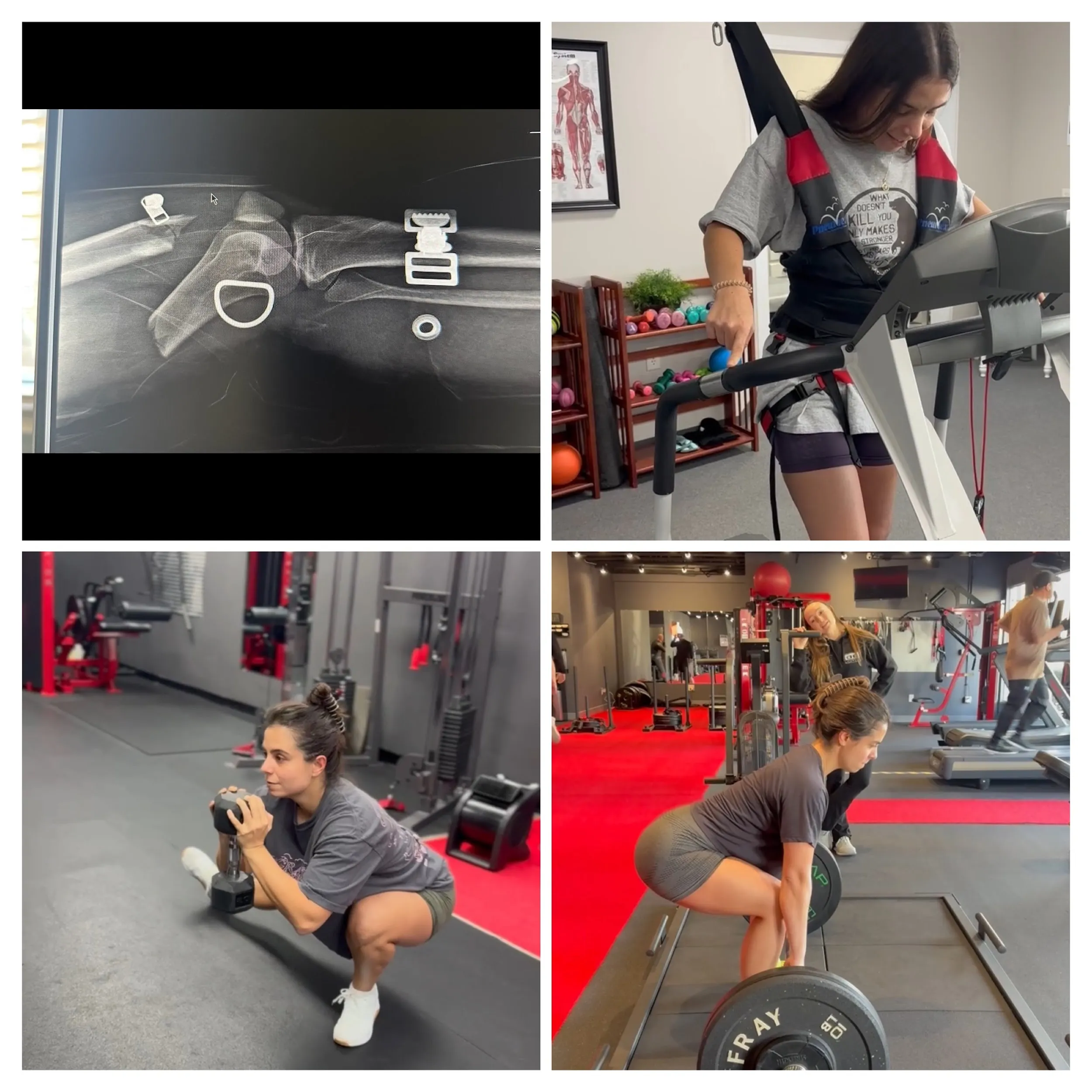 emily-1 darwin fitness older adult client training to fight arthritis